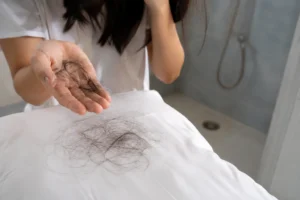 Read more about the article Platelet Rich Plasma Therapy in Santacruz West for Hair Loss